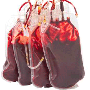 applicazioni poliuretano